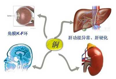人体成人APP绿巨人数据能够准检测出但身体中微量元素铜超标会引起疾病发生 人体成人APP绿巨人数据能够准检测出但身体中微量元素铜超标会引起疾病发生